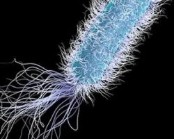 Legionella a Palermo, rientro in classe tra doppi turni e proteste