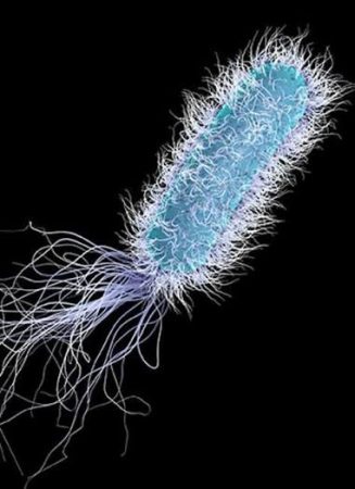 legionella a palermo