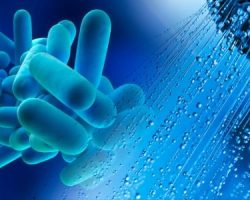 legionella a palermo